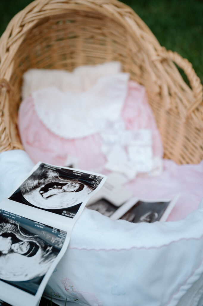 Louisville KY couple shares joyful pregnancy moment during announcement shoot